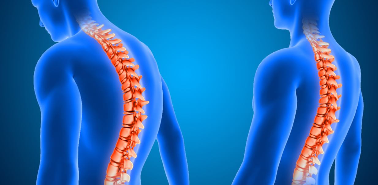 Thoracic spine mobility influenced by lifestyle changes